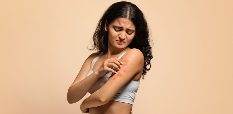 A woman scratching a psoriasis rash on her arm.