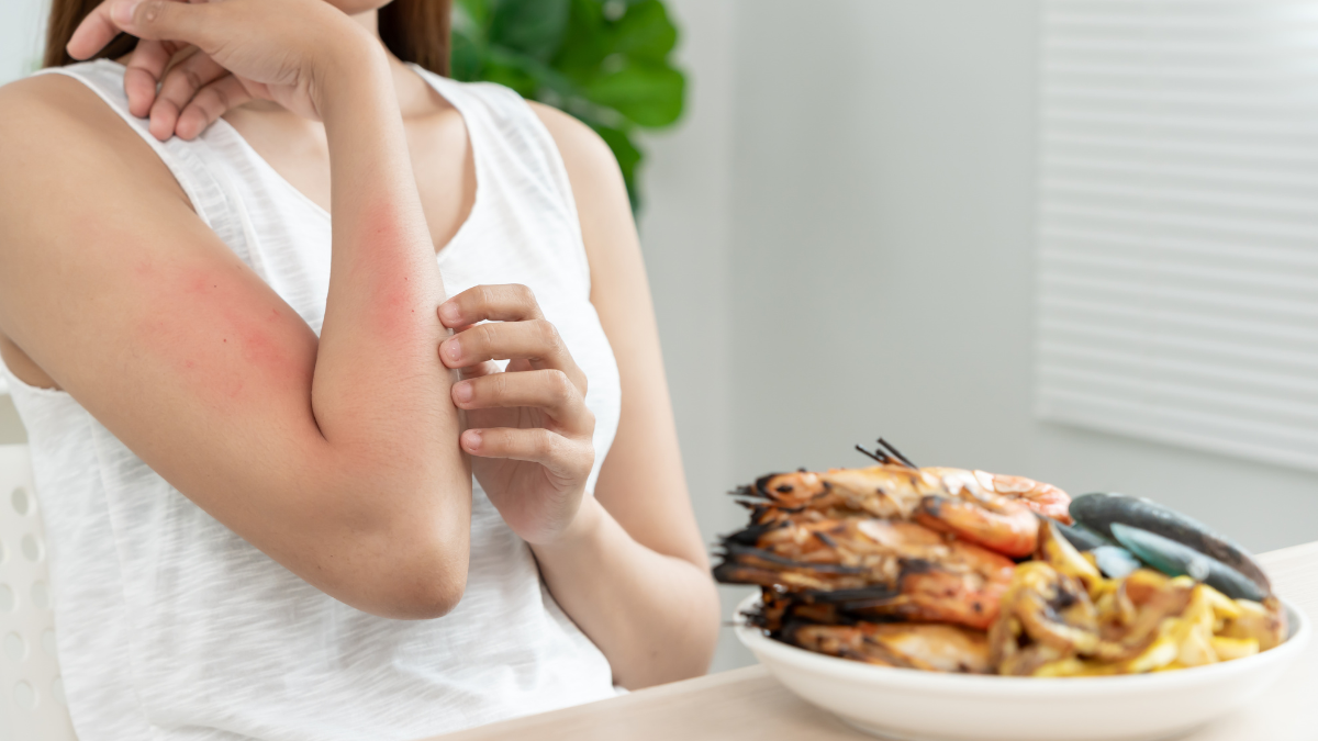 Food allergy